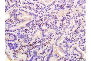 Immunohistochemistry (IHC) image for anti-Cadherin (AA 841-882) antibody (ABIN687682)