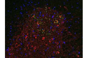 Indirect immunofluorescence labeling of PFA fixed, paraffin embedded mouse spinal cord section with anti-SV 31 (dilution 1 : 500; red) and guinea pig anti-VAchT (, dilution 1 : 500, green). (TMEM163 抗体  (AA 44-63))