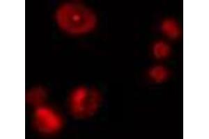 ABIN6274476 staining Hela cells by IF/ICC. (ZNF668 抗体  (Internal Region))