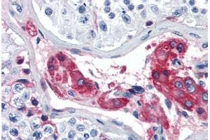 Human Testis (formalin-fixed, paraffin-embedded) stained with F12 antibody ABIN364435 at 5 ug/ml followed by biotinylated anti-goat IgG secondary antibody ABIN481715, alkaline phosphatase-streptavidin and chromogen. (F12 抗体)