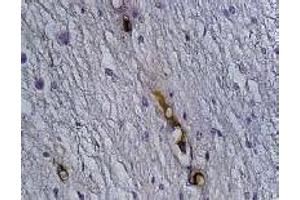 Immunohistochemistry (IHC) image for anti-Synaptophysin (SYP) antibody (ABIN1109181) (Synaptophysin 抗体)