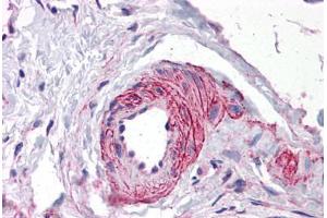 Human Vessel: Formalin-Fixed, Paraffin-Embedded (FFPE) (ERG 抗体  (AA 1-160))