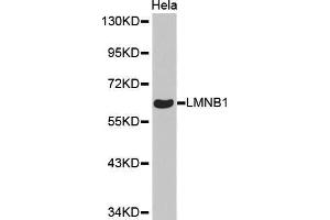 Western Blotting (WB) image for anti-Lamin B1 (LMNB1) antibody (ABIN1513160) (Lamin B1 抗体)