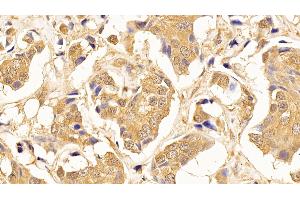 Immunohistochemistry (IHC) image for anti-Tubulin, beta (TUBB) (AA 170-419) antibody (ABIN7428434)