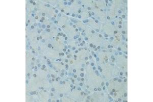 Immunohistochemistry of paraffin-embedded rat pancreas using GTF2H2C antibody  at dilution of 1:100 (40x lens). (GTF2H2C 抗体  (AA 1-300))