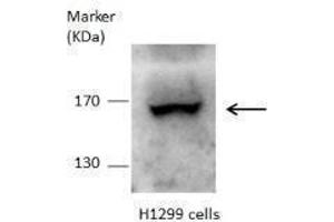 WB Image DOT1L antibody detects DOT1L protein by Western blot analysis.