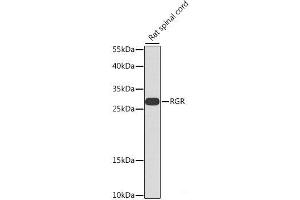 Western blot analysis of extracts of Rat spinal cord using RGR Polyclonal Antibody at dilution of 1:1000. (RGR 抗体)