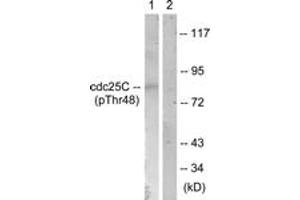 Western blot analysis of extracts from RAW264. (CDC25C 抗体  (pThr48))