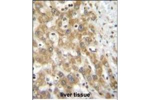 NPS3A Antibody (Center) (ABIN655107 and ABIN2844739) immunohistochemistry analysis in formalin fixed and paraffin embedded human liver tissue followed by peroxidase conjugation of the secondary antibody and DAB staining. (NIPSNAP3A 抗体  (AA 74-102))