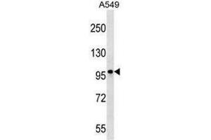 CCDC141 Antibody (N-term) western blot analysis in A549 cell line lysates (35µg/lane). (CCDC141 抗体  (N-Term))