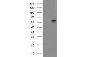 Western Blotting (WB) image for anti-Phosphoribosyl Pyrophosphate Amidotransferase (PPAT) (AA 42-278) antibody (ABIN1491502) (PPAT 抗体  (AA 42-278))