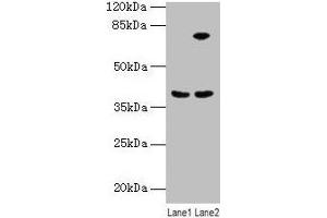 Western blot All lanes: ANXA9 antibody at 8 μg/mL Lane 1: Mouse kidney tissue Lane 2: A431 whole cell lysate Secondary Goat polyclonal to rabbit IgG at 1/10000 dilution Predicted band size: 39 kDa Observed band size: 39 kDa (Annexin A9 抗体  (AA 8-345))