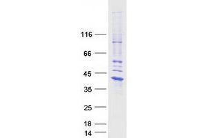 Western Blotting (WB) image for Interleukin 1, beta (IL1B) protein (Myc-DYKDDDDK Tag) (ABIN2723572)