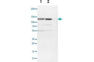 Western blot anyalysis of Lane 1: NIH-3T3 cell lysate (Mouse embryonic fibroblast cells), Lane 2: NBT-II cell lysate (Rat Wistar bladder tumour cells), Lane 3: PC12 cell lysate (Pheochromocytoma of rat adrenal medulla) with NCAPH polyclonal antibody . (NCAPH 抗体)