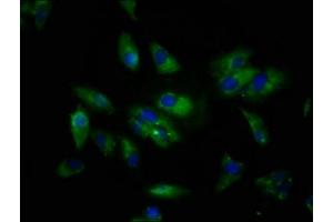 Immunofluorescence staining of Hela cells with ABIN7169553 at 1:133, counter-stained with DAPI. (Sialoadhesin/CD169 抗体  (AA 572-697))