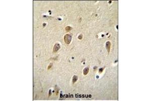 Immunohistochemistry (Paraffin-embedded Sections) (IHC (p)) image for anti-Arginyl-tRNA Synthetase (RARS) (AA 605-634), (C-Term) antibody (ABIN655043)