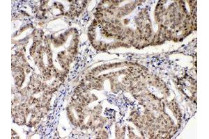 Immunohistochemistry (IHC) image for anti-X-Ray Repair Complementing Defective Repair in Chinese Hamster Cells 1 (XRCC1) (AA 538-633) antibody (ABIN5693138)