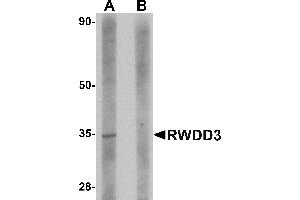 Western blot analysis of RWDD3 in rat kidney tissue lysate with RWDD3 antibody at 1 µg/mL in (A) the absence and (B) the presence of blocking peptide. (RWDD3 抗体  (C-Term))