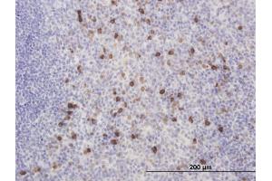 Immunoperoxidase of monoclonal antibody to KCNIP2 on formalin-fixed paraffin-embedded human tonsil. (KCNIP2 抗体  (AA 1-100))
