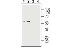 Western blot analysis of human  colon adenocarcinoma cell line lysate (lanes 1 and 3) and human  retinal pigment epithelium cell line lysate (lanes 2 and 4):1,2.
