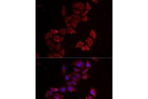 Immunofluorescence analysis of MCF7 cells using LIMS1 Polyclonal Antibody (LIMS1 抗体)
