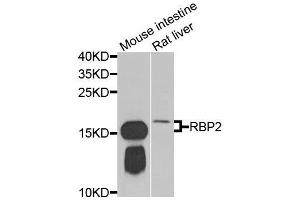 Western blot analysis of extracts of various cell lines, using RBP2 antibody. (RBP2 抗体  (AA 1-134))