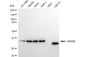 Western blotting analysis using TIMM50 antibody (ABIN7800615).