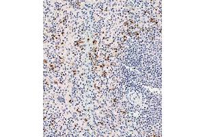 Immunohistochemical analysis of (ABIN1537232 and ABIN2838268) on paraffin-embedded human spleen tissue was performed on the Leica®BOND RXm. (DEFa3 抗体  (C-Term))