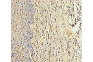 Immunohistochemistry of paraffin-embedded human tonsil tissue using ABIN7176084 at dilution of 1:100 (ZMAT5 抗体  (AA 1-170))