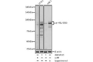 Western blot analysis of extracts of various cell lines, using Phospho-HSL-S563 antibody (ABIN7268278) at 1:1000 dilution. (LIPE 抗体  (pSer563))