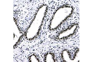 Immunohistochemistry (IHC) image for anti-Chromobox Homolog 3 (CBX3) (AA 2-183) antibody (ABIN5693033)