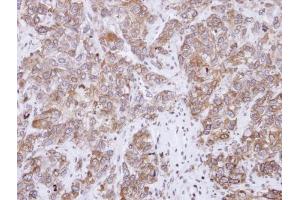 IHC-P Image Immunohistochemical analysis of paraffin-embedded FaDu xenograft, using CD2-associated protein, antibody at 1:500 dilution. (CD2AP 抗体)