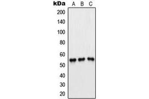Western blot analysis of PFKFB1/4 expression in Jurkat (A), H1299 (B), HeLa (C) whole cell lysates. (PFKFB1/4 抗体  (Center))