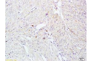 Immunohistochemistry (Paraffin-embedded Sections) (IHC (p)) image for anti-Killer Cell Lectin-Like Receptor Subfamily B, Member 1 (KLRB1) (AA 151-225) antibody (ABIN680998)