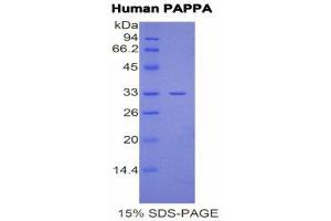 SDS-PAGE (SDS) image for Pregnancy-Associated Plasma Protein A, Pappalysin 1 (PAPPA) (AA 244-501) protein (His tag) (ABIN1877279) (PAPPA Protein (AA 244-501) (His tag))