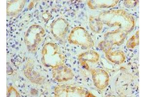Immunohistochemistry of paraffin-embedded human kidney tissue using ABIN7145103 at dilution of 1:100 (ATG13 抗体  (AA 318-517))
