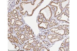 IHC analysis of Annexin A3 using anti-Annexin A3 antibody (ABIN7602989).