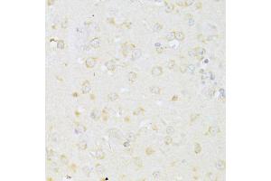 Immunohistochemistry of paraffin-embedded mouse brain using CHRNA7 antibody (ABIN4903285) at dilution of 1:100 (40x lens). (CHRNA7 抗体)