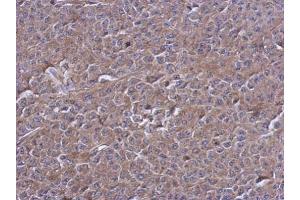 IHC-P Image Immunohistochemical analysis of paraffin-embedded D54 xenograft, using PTPN12, antibody at 1:500 dilution. (PTPN12 抗体  (N-Term))
