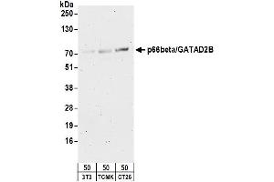 Western Blotting (WB) image for anti-GATA Zinc Finger Domain Containing 2B (GATAD2B) (AA 1-50) antibody (ABIN7451927)