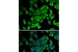 Immunofluorescence analysis of MCF7 cells using PPL Polyclonal Antibody (PPL 抗体)
