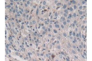 Immunohistochemistry (IHC) image for anti-Syntaxin 2 (STX2) (AA 8-262) antibody (ABIN7435208)