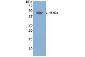 Detection of Recombinant DSG3, Human using Polyclonal Antibody to Desmoglein 3 (DSG3) (Desmoglein 3 抗体  (AA 858-999))