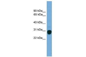 TREM2 antibody used at 1 ug/ml to detect target protein. (TREM2 抗体  (Middle Region))