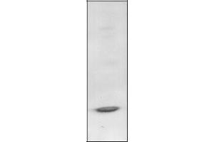 Western Blotting (WB) image for anti-B-Cell CLL/lymphoma 3 (BCL3) antibody (ABIN950631) (BCL3 抗体)