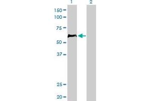 Western Blotting (WB) image for anti-Hematopoietic Cell-Specific Lyn Substrate 1 (HCLS1) (AA 266-356) antibody (ABIN598723) (HCLS1 抗体  (AA 266-356))