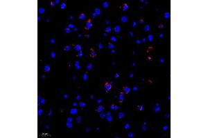 Immunofluorescence of paraffin embedded rat brain using Neurturin (ABIN7074832) at dilution of 1:1000 (400x lens) (Neurturin 抗体)