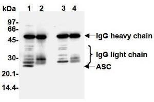 Western Blotting (WB) image for anti-PYD and CARD Domain Containing (PYCARD) antibody (ABIN1105662) (PYCARD 抗体)