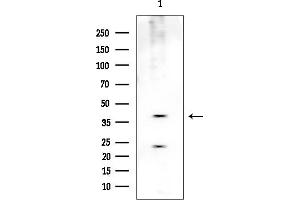 anti-Protein Kinase, X-Linked (PRKX) (Internal Region) antibody