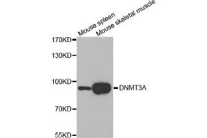 Western blot analysis of extracts of various cell lines, using DNMT3A antibody (ABIN1872325). (DNMT3A 抗体)